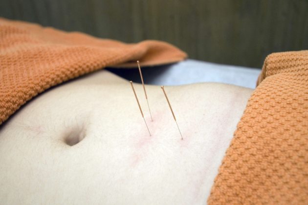 Acupuncture & Oriental Medicine